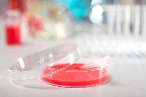Cell culture dish