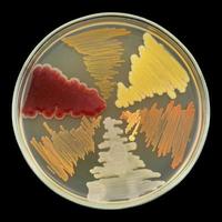 crecimiento de cultivos bacterianos en placa de placa de Petri aislada en negro foto