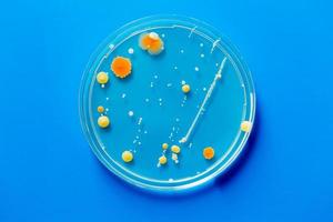 placa de Petri con colonias de microbios patológicos foto