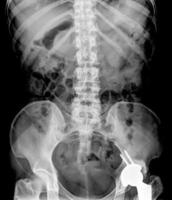 x-ray photo