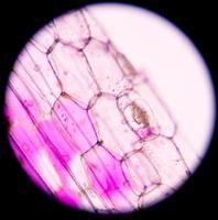 Células vegetales rosadas bajo microscopio. foto