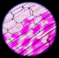 células vegetales bajo microscopio 400x
