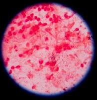 bacteria foto