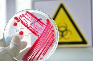 placa de Petri con colonia roja de bacterias y fondo de riesgo biológico