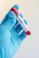 Helicobacter pylori (H.pylori) blood sample photo