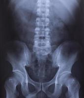 Radiografía de la pelvis y la columna vertebral. foto