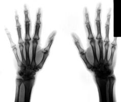 film X-Ray scan human photo