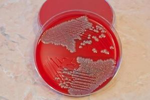 Escherichia Colli bacteria isolated on petri dish photo