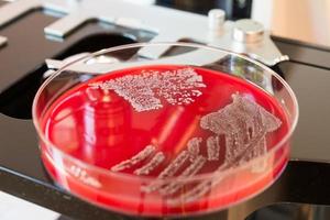 Colonias de bacterias en placas de Petri en el fondo del microscopio foto