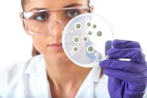 Mujer en bata de laboratorio y guantes de control de bacterias en placa de Petri