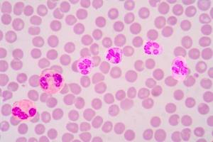 White blood cells photo