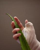 Injured hand with cast holding aloe vera leaf
