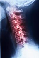 Radiografía de resonancia magnética del cuello de la columna vertebral y el estrés de la cabeza foto