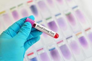 Blood group test photo