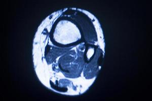 resonancia magnética de resonancia magnética médica foto
