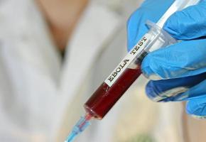 médico virólogo durante la prueba del virus del ébola foto
