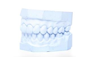 Plaster cast of teeth