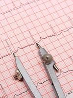 Electrocardiogram graph report and calipers