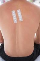paciente con prueba de piel en la espalda foto