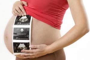 Pregnant woman holding ultrasound photo