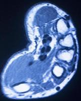 MRI magnetic resonance imaging hand fingers scan
