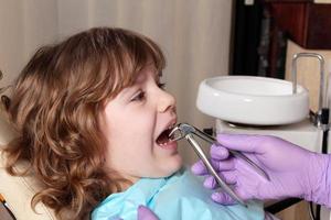 dentist extracted the tooth little girl photo