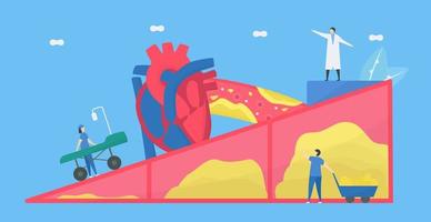 Atherosclerosis Concept with Doctors Fixing Artery vector