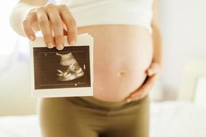 mujer embarazada con imagen de ultrasonido