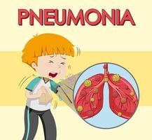 Poster design for pneumonia with boy coughing vector