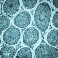 sección microscópica del tejido testicular