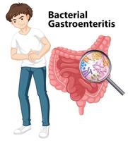 diagrama que muestra gastroenteritis bacteriana vector