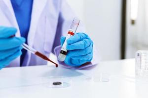 Scientist is testing blood sample  photo
