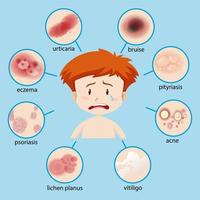 Diagram showing boy with different skin conditions vector