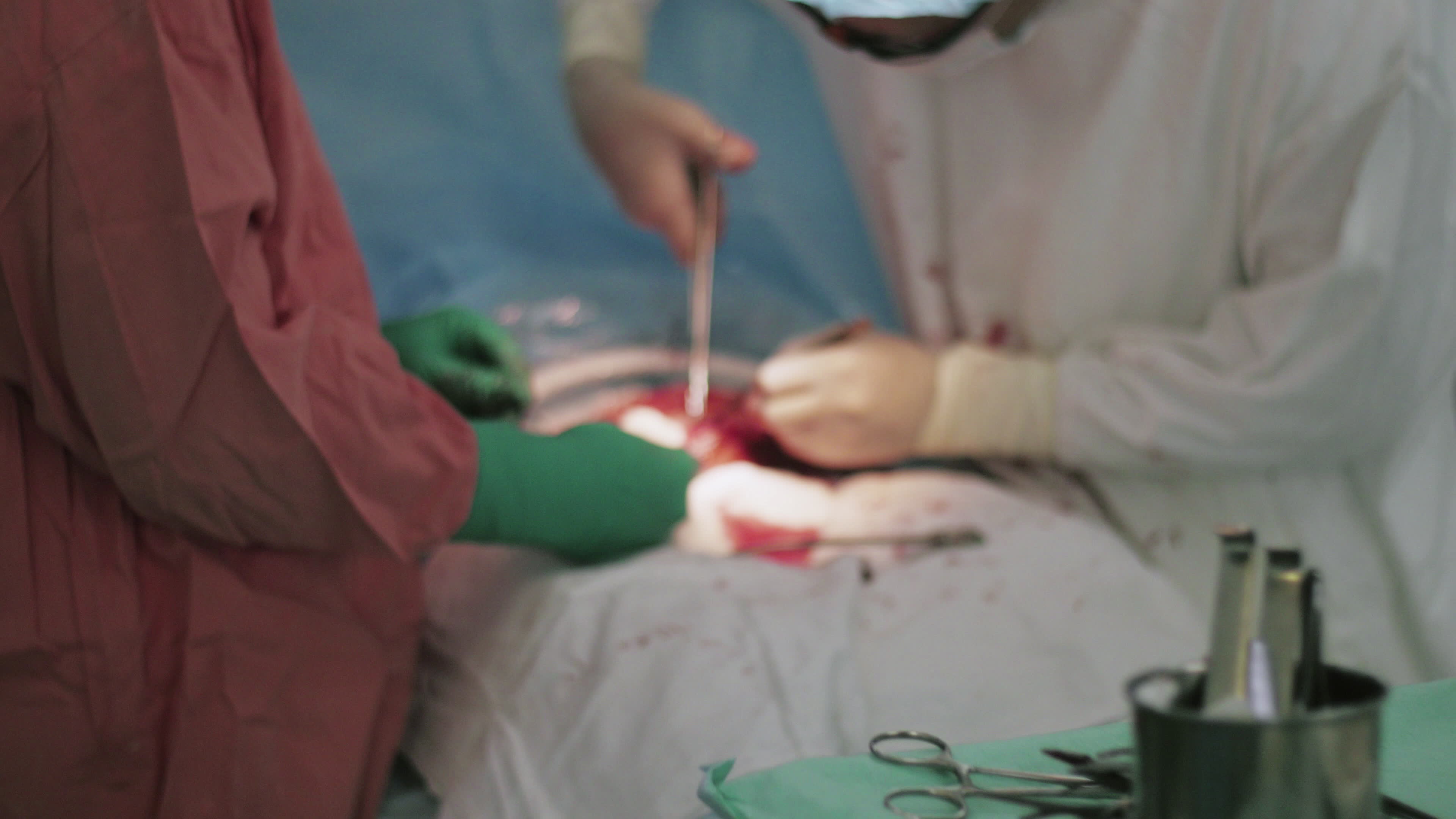 Surgeons sew up stomach woman by needle and thread. Cesarean section