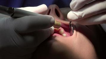 Zahnarzt praktizieren eine Oberflächenanästhesie