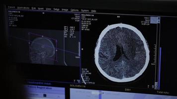 MRI scan of brain on Monitor in control room and and monitoring patient