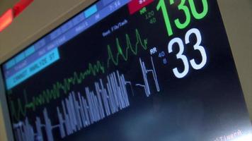 Heart Monitor Warning EKG video