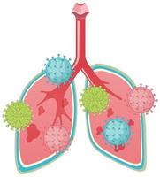 Lungs attacked by coronavirus cartoon style vector