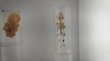 espécimes médicos de feto e esqueleto video