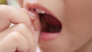 Close up of little girl wiggling her front baby tooth.