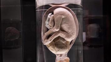 Close up de spécimen médical préservé de foetus