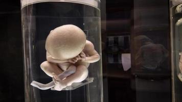 detalhe de espécime médico preservado de feto video
