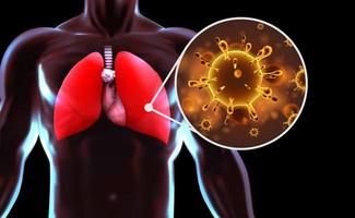 Viruses in human lungs, coronavirus vector