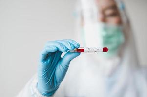 Coronavirus blood test photo