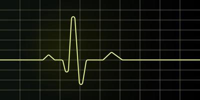 Electrocardiogram screen and graph vector