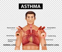 Diagram showing Asthma on transparent background vector