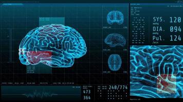 Hjärna 3d och vitala tecken med neurologisk display för statistisk data video