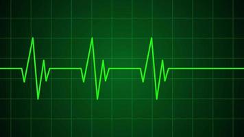 Heartbeat Medical Cardiogram Animation video