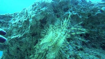 A Hand Is Touching To An Annelida video