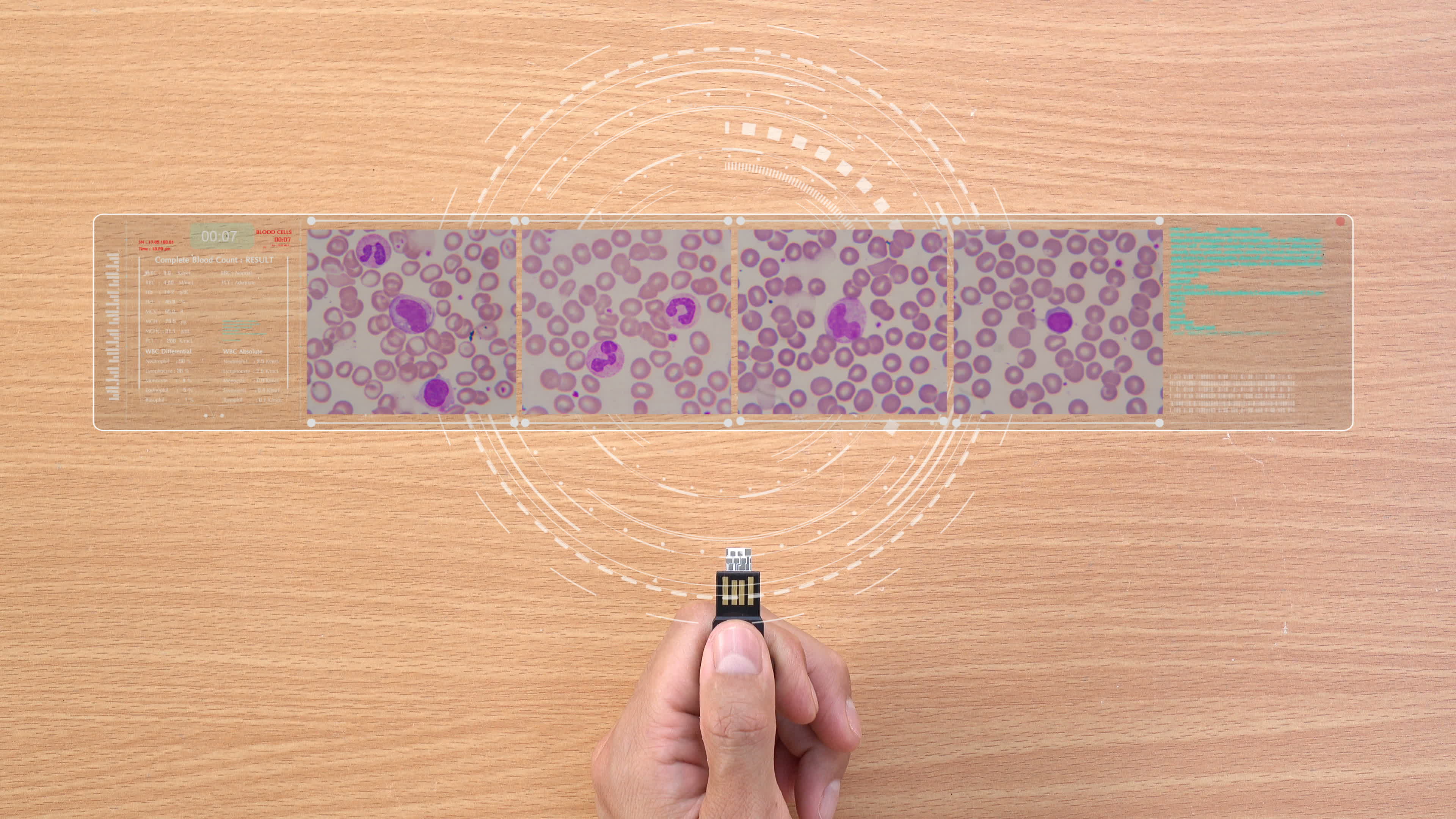 Complete blood count testing your self at home 2021093 Stock Video at